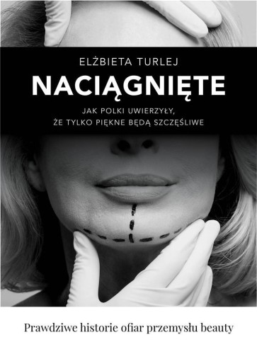 Naciągnięte, Elżbieta Turlej