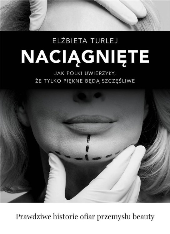 Naciągnięte, Elżbieta Turlej