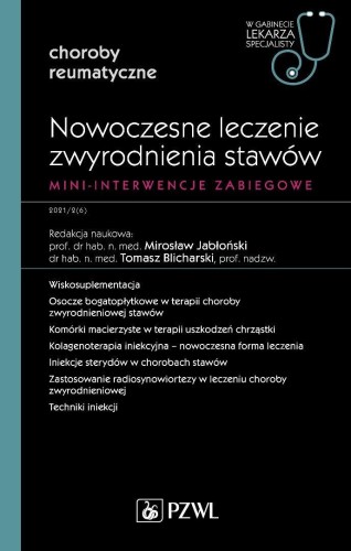Nowoczesne leczenie zwyrodnienia stawów