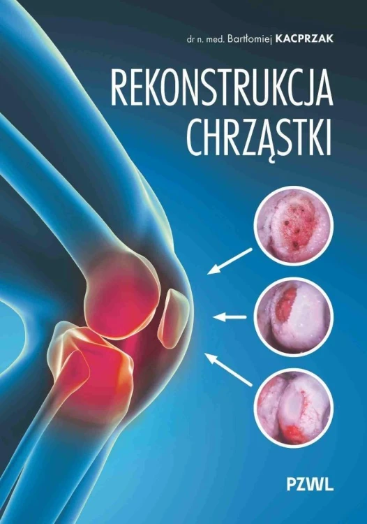 Rekonstrukcja chrząstki, Bartłomiej Kacprzak