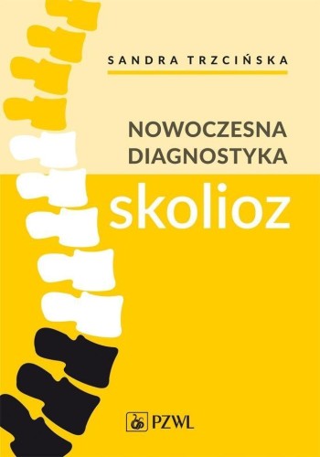 Nowoczesna diagnostyka skolioz, Sandra Trzcińska