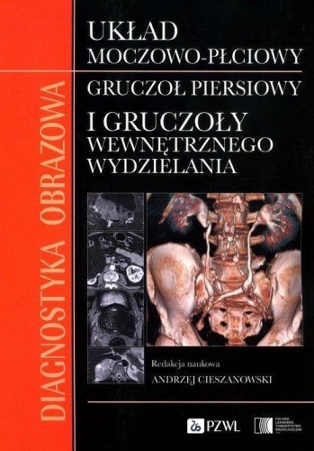 Diagnostyka obrazowa Układ moczowo-płciowy Gruczoł