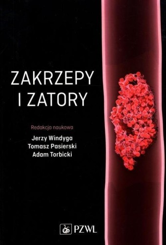 Zakrzepy i zatory, praca zbiorowa