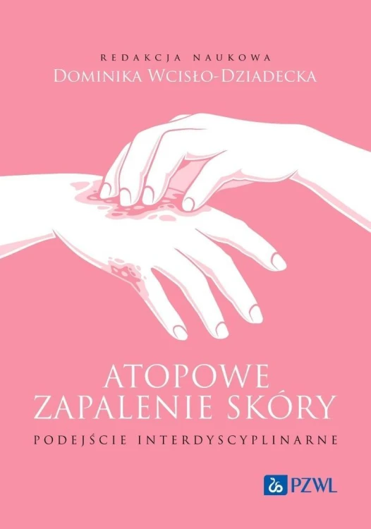 Atopowe zapalenie skóry. Podejście interdyscyplina
