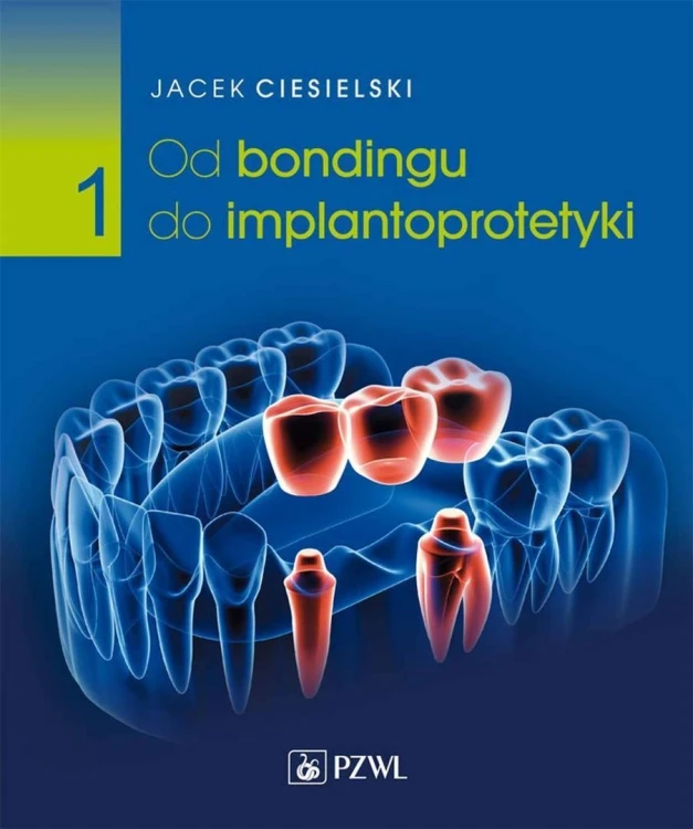 Od bondingu do implantoprotetyki cz. I