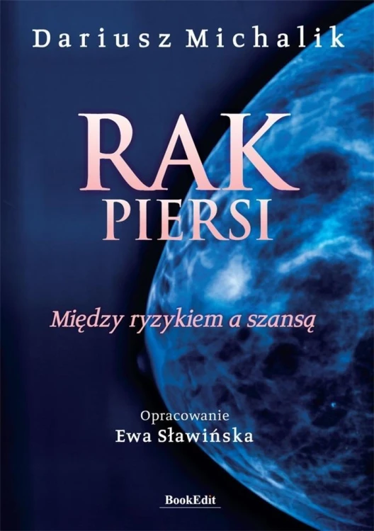 Rak piersi. Między ryzykiem a szansą