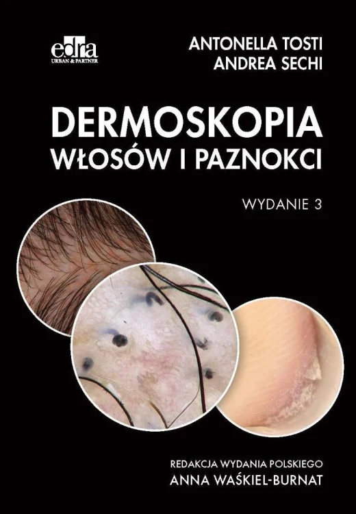 Dermoskopia włosów i paznokci, A. Sechi, A. Tosti