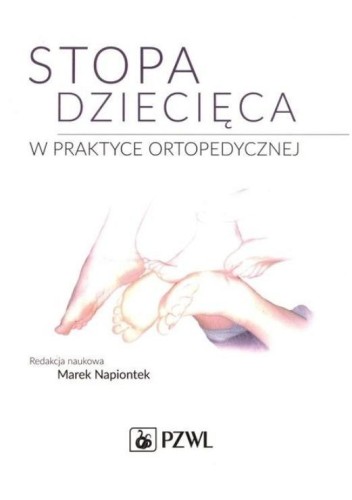 Stopa dziecięca w praktyce ortopedycznej